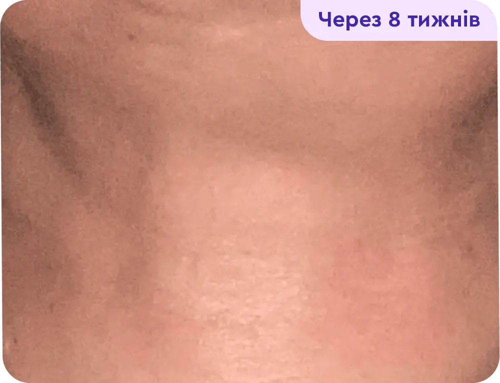 A close-up view of a smooth torso, showing skin with a light tone and slight shine. The image features a label in the corner that reads "After 8 weeks," suggesting progress or change over an eight-week period. The focus is on the skin's texture and appearance, emphasizing a healthy and polished look.